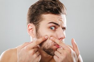 consejos para eliminar el acné